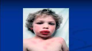 Food Allergies part 1 | Dr. Alan Nathans | Jacksonville, Fl 32256