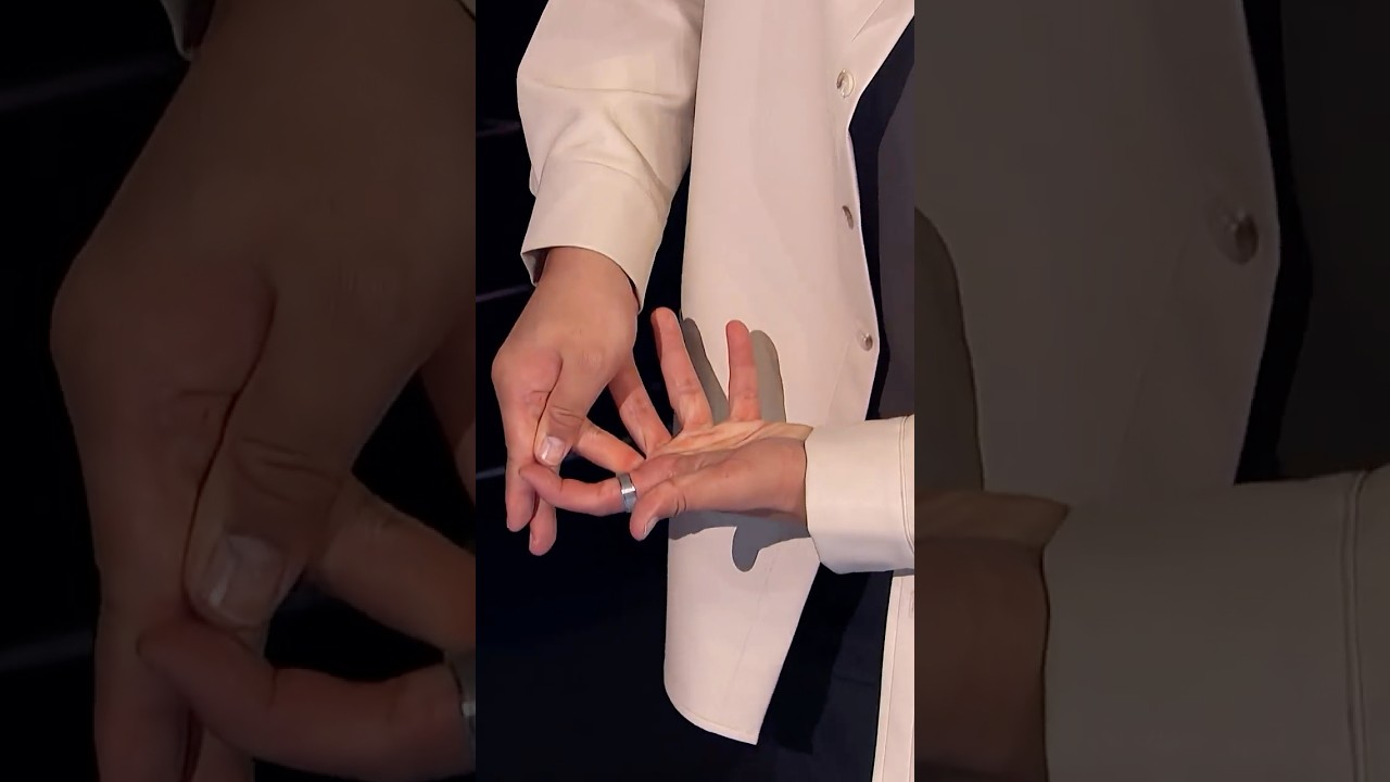 he cut his own finger off... then put it back! 😲