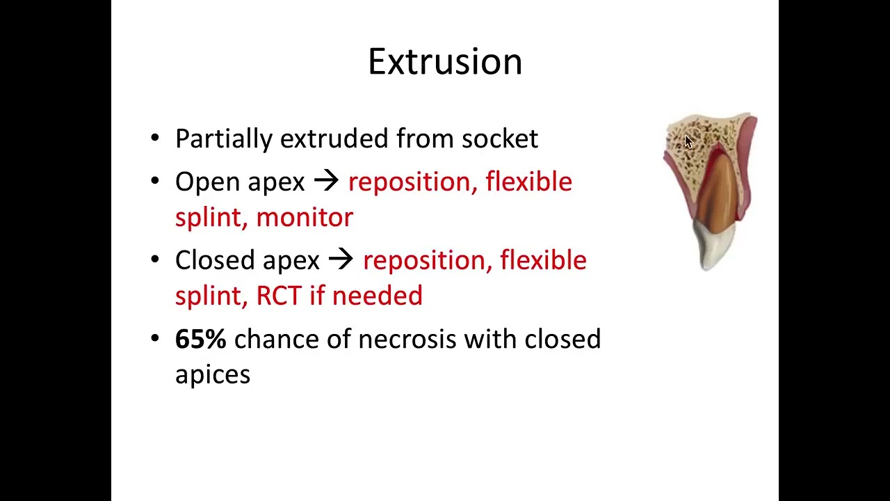 أساسيات طب اعصاب الاسنان (Traumatic Injuries) | جامعة الملك سعود