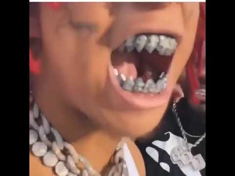 Ice on my teeth