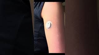 Applying my new Dexcom Sensor!! @dexcomCGM @DexcomCanadaEnglish