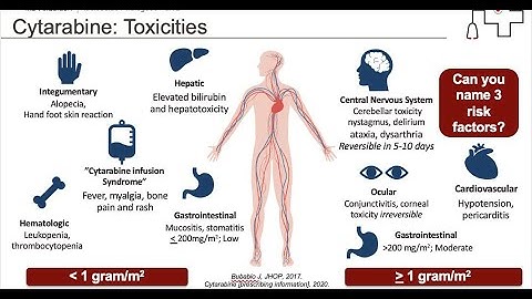 Cytarabine Syndrome and Cytarabine Toxicity side effect of cytarabine Ara C chemotherapy