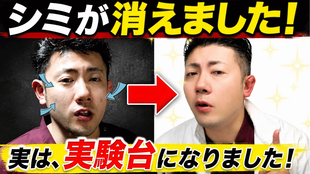 【僕がシミを消した方法！】実際にシミが消えた方法です！