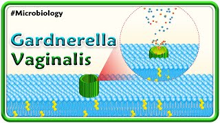 Gardnerella Vaginalis | Microbiology USMLE Step 1