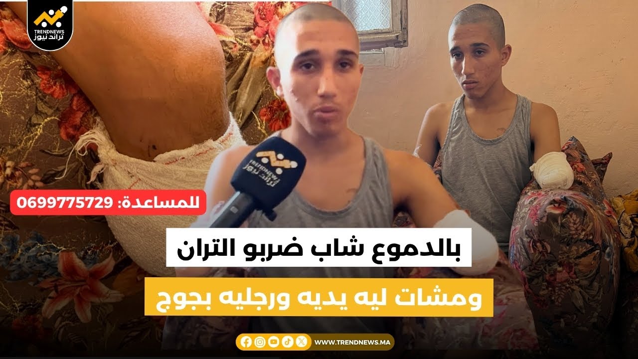 🚨 مباشرة من #آسفي : قصة سوف تهز المغاربة إبراهيم 20 سنة ضربو التران ومشات ليه يديه ورجليه بجوج