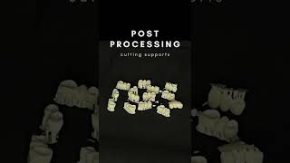 "Crown & Bridge Post Processing - Cutting Supports"