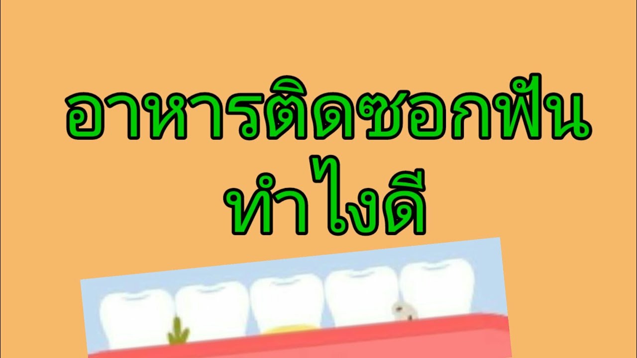 อาหารติดซอกฟัน ทำไงดี | อาหาร ติด ซอก ฟันข้อมูลล่าสุดที่เกี่ยวข้อง