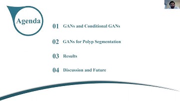 Generative Adversarial Networks for Automatic Polyp Segmentation