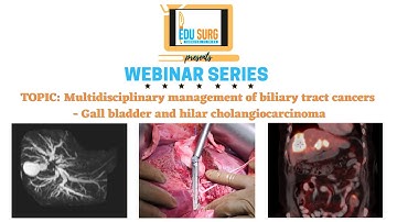 Zoom webinar - gall bladder cancer - hilar cholangiocarcinoma - Multidisciplinary cancer management