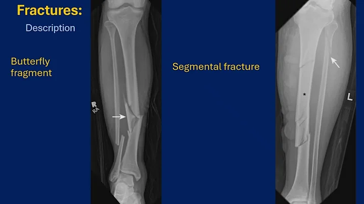 D. K. Bielecki - Physical injury: Basic concepts - part I.