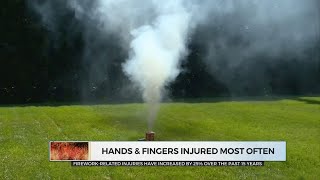 New Report Shows Increase In Firework Injuries Over The Past 15 Years
