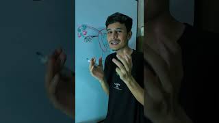 Ectopic Pregnancy Explained #meditale #facts