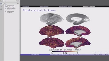 Konrad Wagstyl: Linking cortical microstructure and in vivo measures of cortical structure