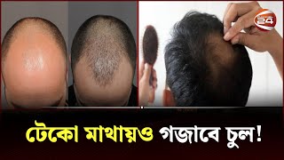 টাক মাথায় চুল গজানোর সহজ উপায় | TAK PROBLEM | Channel 24 screenshot 1