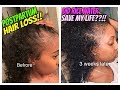 RICE WATER RINSE! POST PARTUM HAIR LOSS AND MY GROWTH
