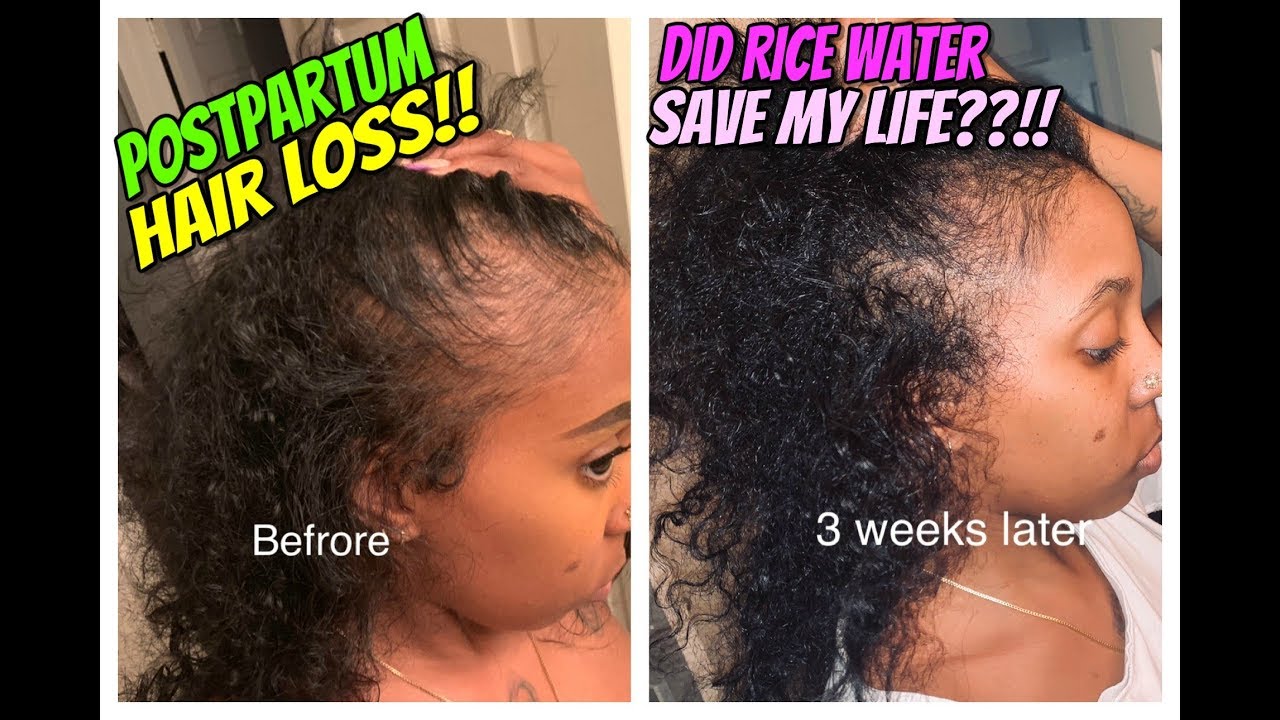 RICE WATER RINSE! POST PARTUM HAIR LOSS AND MY GROWTH YouTube