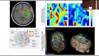 Pallavi Tiwari - AI, Computational Imaging, and the Quest for Precision