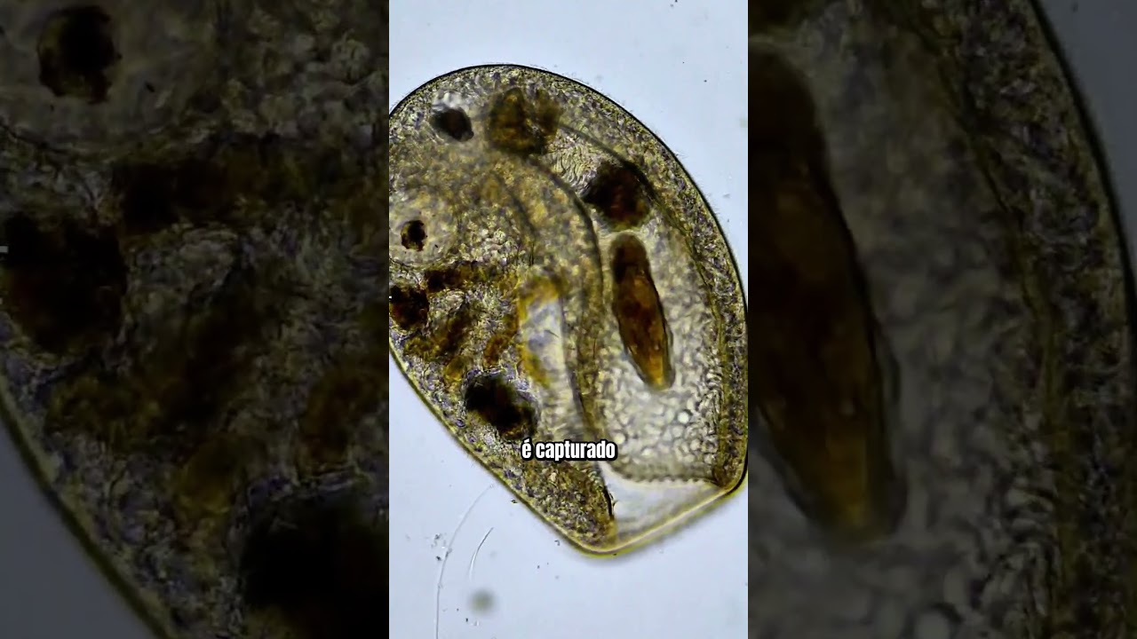 Bursaria: Um protozoário esquisito que adora devorar Paramécios 