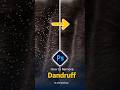 How to Remove Dandruff in Photoshop – Quick Retouch #Shorts  #photoshoptutorial #AI  #graphicdesign