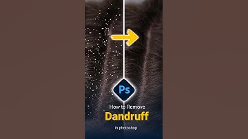 How to Remove Dandruff in Photoshop – Quick Retouch #Shorts  #photoshoptutorial #AI  #graphicdesign