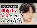 まじで肌荒れ治したい人だけみてください。【ニキビ歴5年の答え】