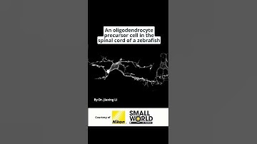 Brain Cells in the Spinal Cord of Zebrafish!