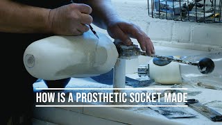 HOW  IS A PROSTHETIC SOCKET MADE. Most comprehensive video of the process. screenshot 3