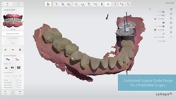 3Shape Implant Studio – A Demo