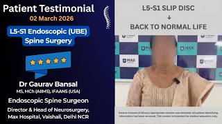 Severe Sciatica & Leg Pain Relieved After 4th Gen Endoscopic Spine Surgery | Patient Experience