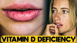 10 Weirdest Signs Of Vitamin D Deficiency
