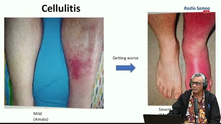 O Lou Soifua Maloloina O lo'o i ou lava Aao (10 JUL 2024)