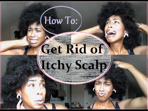 How to: Get rid of itchy scalp | Natural Hair - YouTube