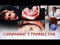 Скрининг 1 триместра 11-13 недель. Зачем делать скрининг в эру НИПТ? Курганников А.С.