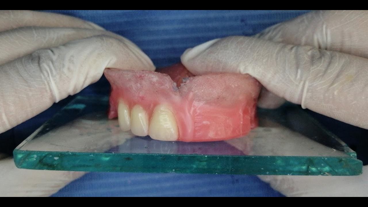 Video 11 - Enfilado anterior (tips)