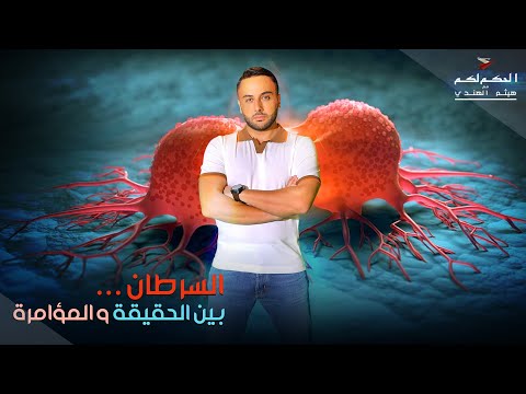 لماذا لا يوجد علاج للسرطان هل هنالك مؤامرة