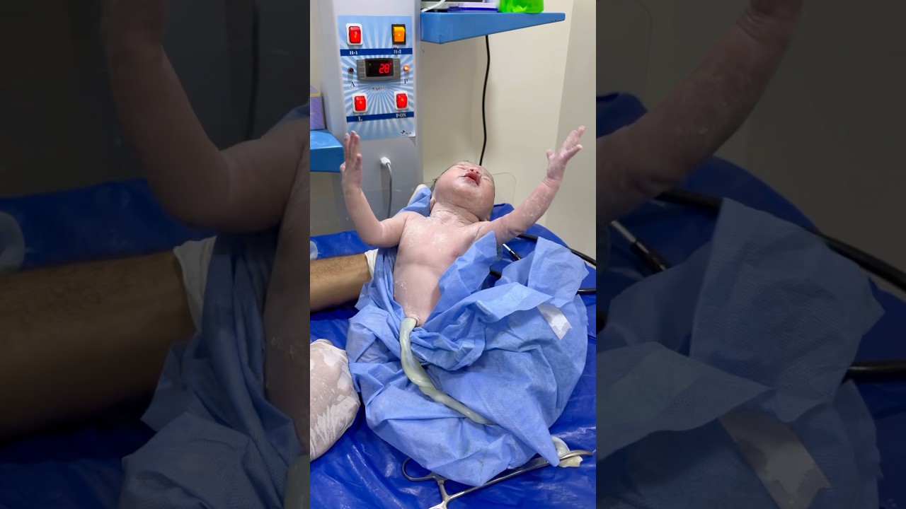 baby first day Moro reflex