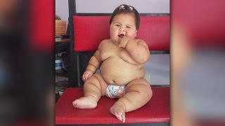 Charity Helping To Save The Life Of Obese Baby