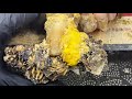 CUT Ingrown Toenails Toenails With Maggots Fungal Toenails TREATMENT OF Ingrown Toenails N146 CUT Ingrown Toenails Toenails With Maggots Fungal Toenails TREATMENT OF Ingrown Toenails N146
