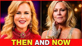 25+ Celebrity Facelifts Gone Wrong | Then and Now 2026