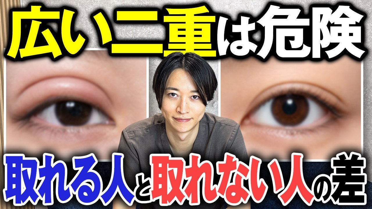 Why buried stitches stay in for years: What makes Dr. Harada's