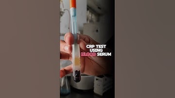 CRP test || c-reaction protein test #shorts #shortsfeed #shortsvideo