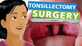 Tonsillectomy Surgery