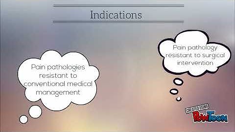Neuromodulation - SCS
