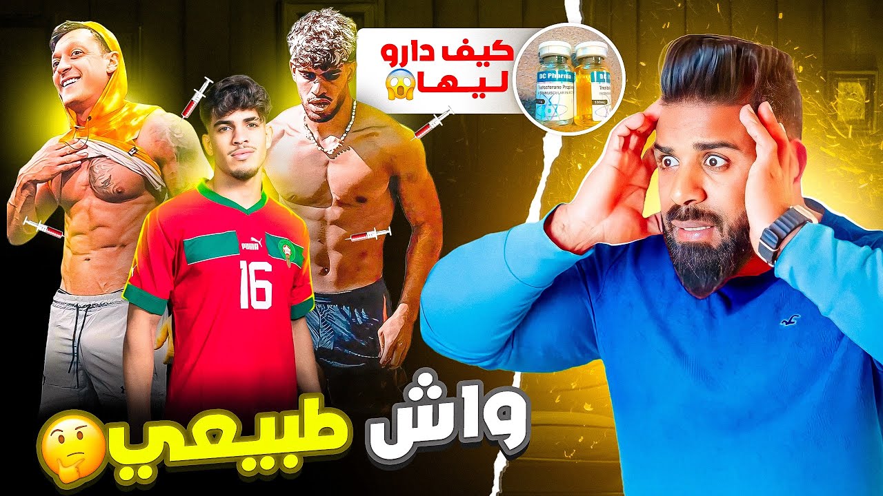 هل هم طبيعيون 🤔 الزلزولي و مسعود أوزيل Transformation واش دوباج 😱