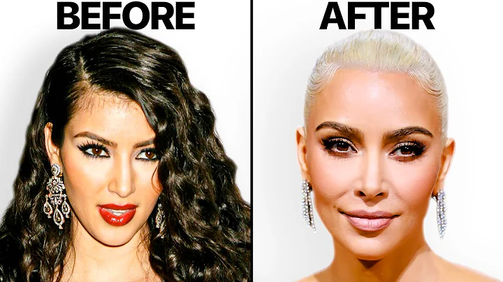 What Happened to Kim Kardashian's Face? | Plastic ...