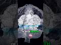 Butyrate is the Holy Grail of Gut and Brain Health! Short Chain Fatty Acids Mp3 Song