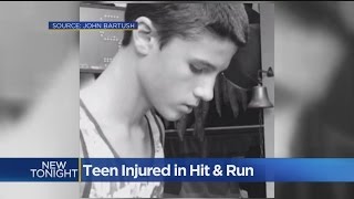 Citrus Heights Teen On Skateboard Seriously Injured In Hit-And-Run Crash