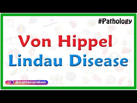 Von hipple-Lindau Disease ( VHL ) - Case based discussion USMLE