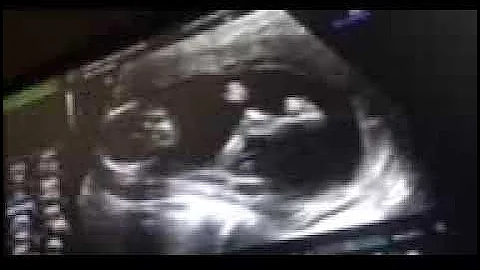 Grandbaby