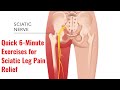 The Best Exercises for  Sciatic Leg Pain Relief